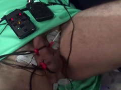 Electrostim treatment In Madame C's Medical Clinic