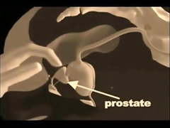 Prostate Massage Techniques
